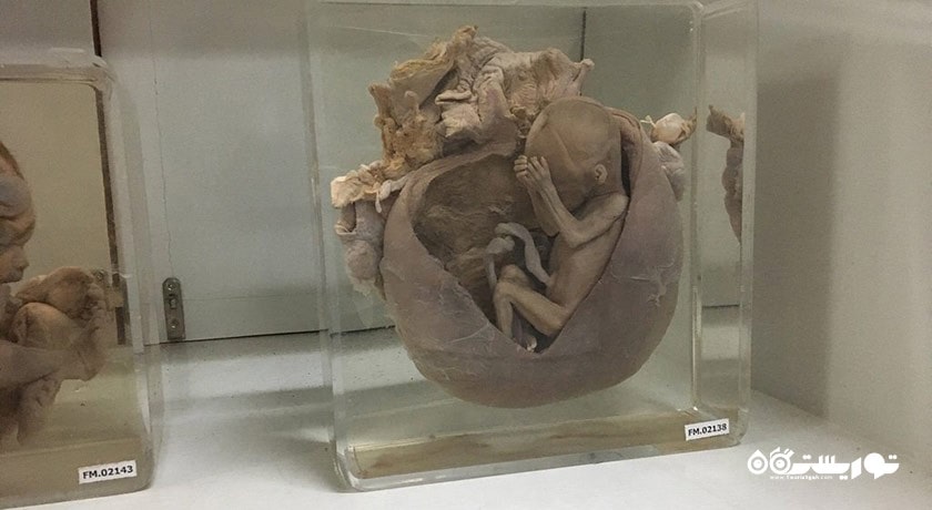  موزه پزشکی بانکوک شهر تایلند کشور بانکوک