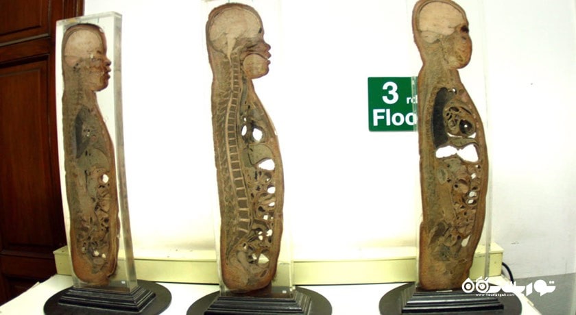  موزه پزشکی بانکوک شهر تایلند کشور بانکوک