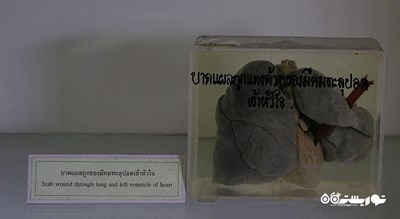  موزه پزشکی بانکوک شهر تایلند کشور بانکوک